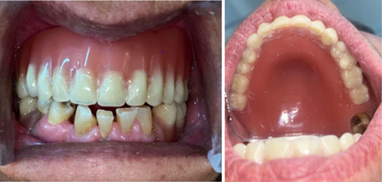 Online Open Access Dental Magazine, Journal, Publication, Dentistry Journal