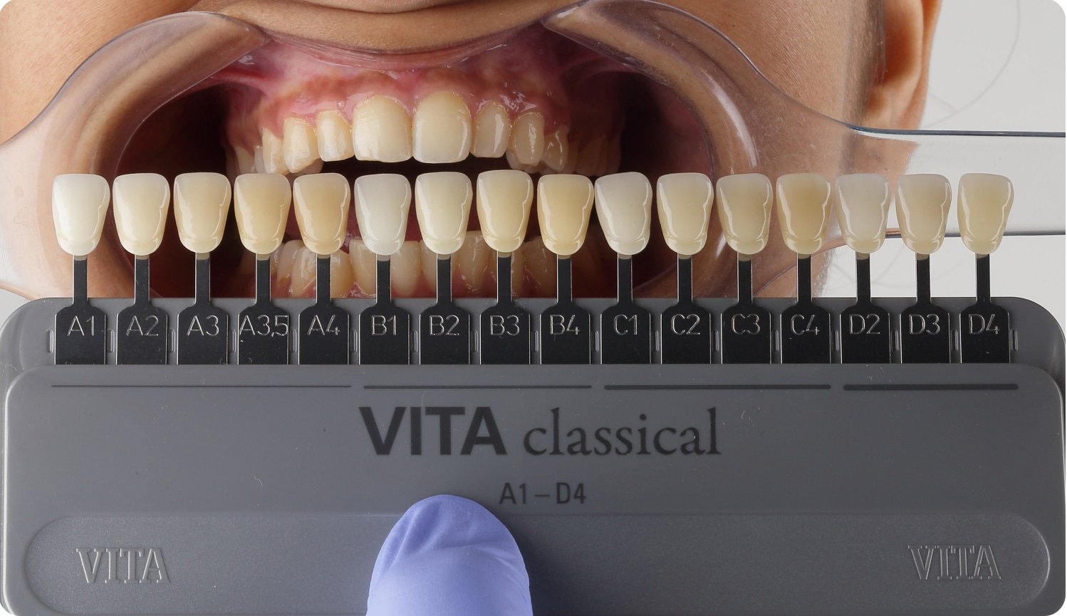 Online Open Access Dental Magazine, Journal, Publication, Dentistry Journal