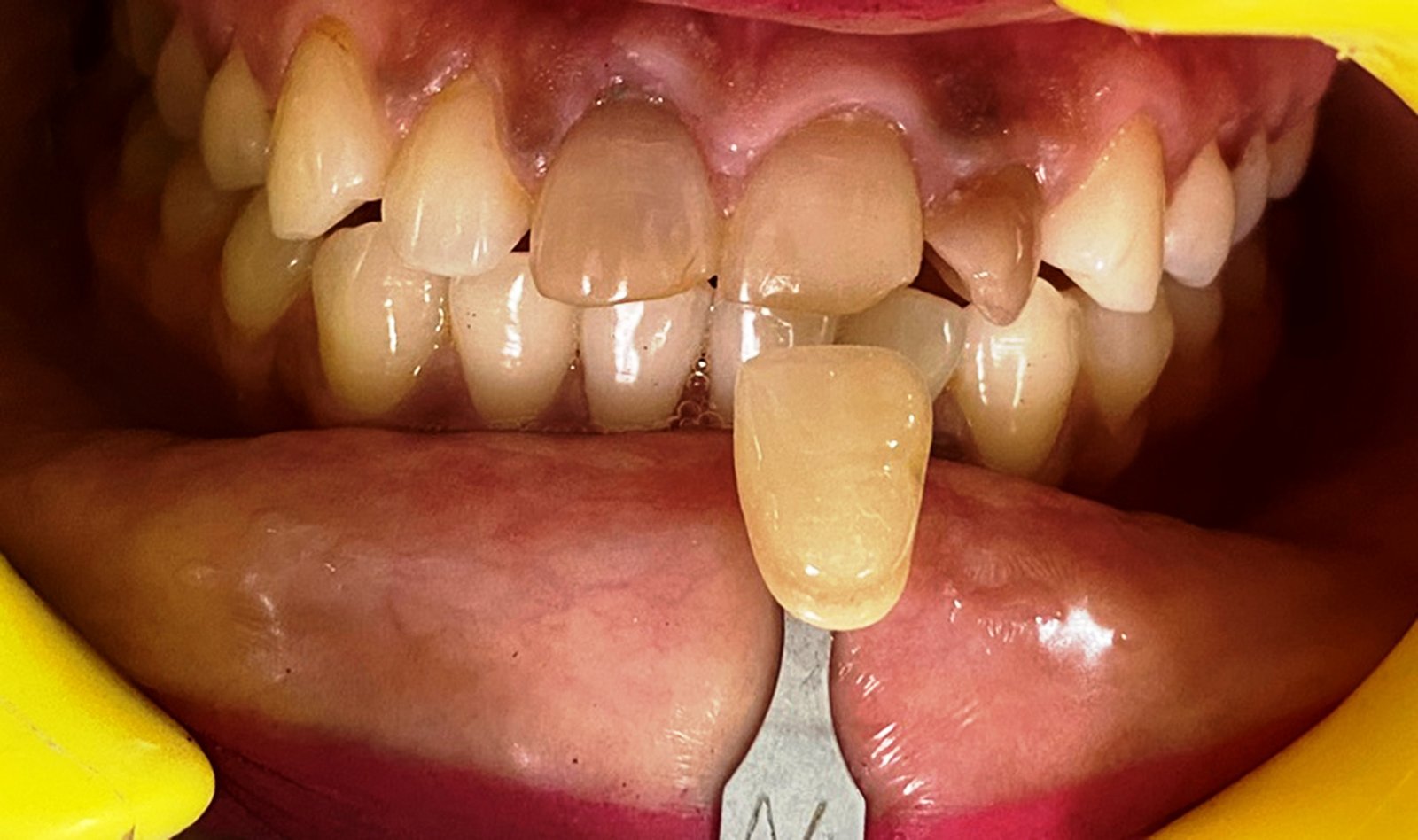 Online Open Access Dental Magazine, Journal, Publication, Dentistry Journal