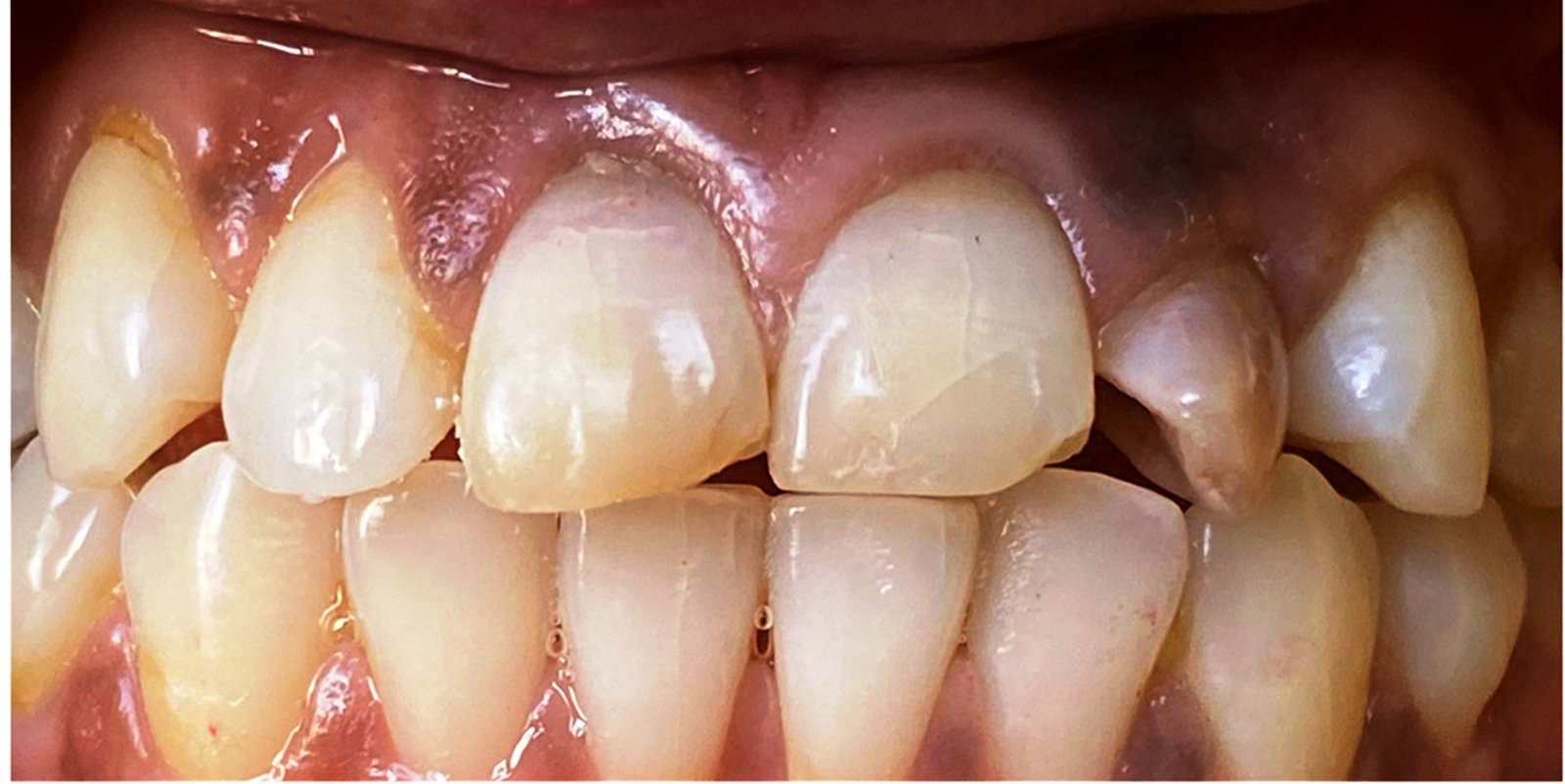 Online Open Access Dental Magazine, Journal, Publication, Dentistry Journal