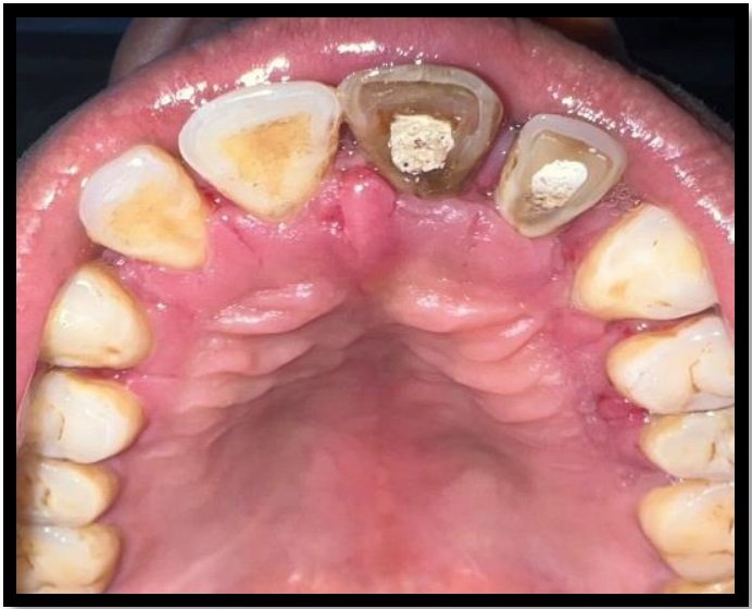 Online Open Access Dental Magazine, Journal, Publication, Dentistry Journal