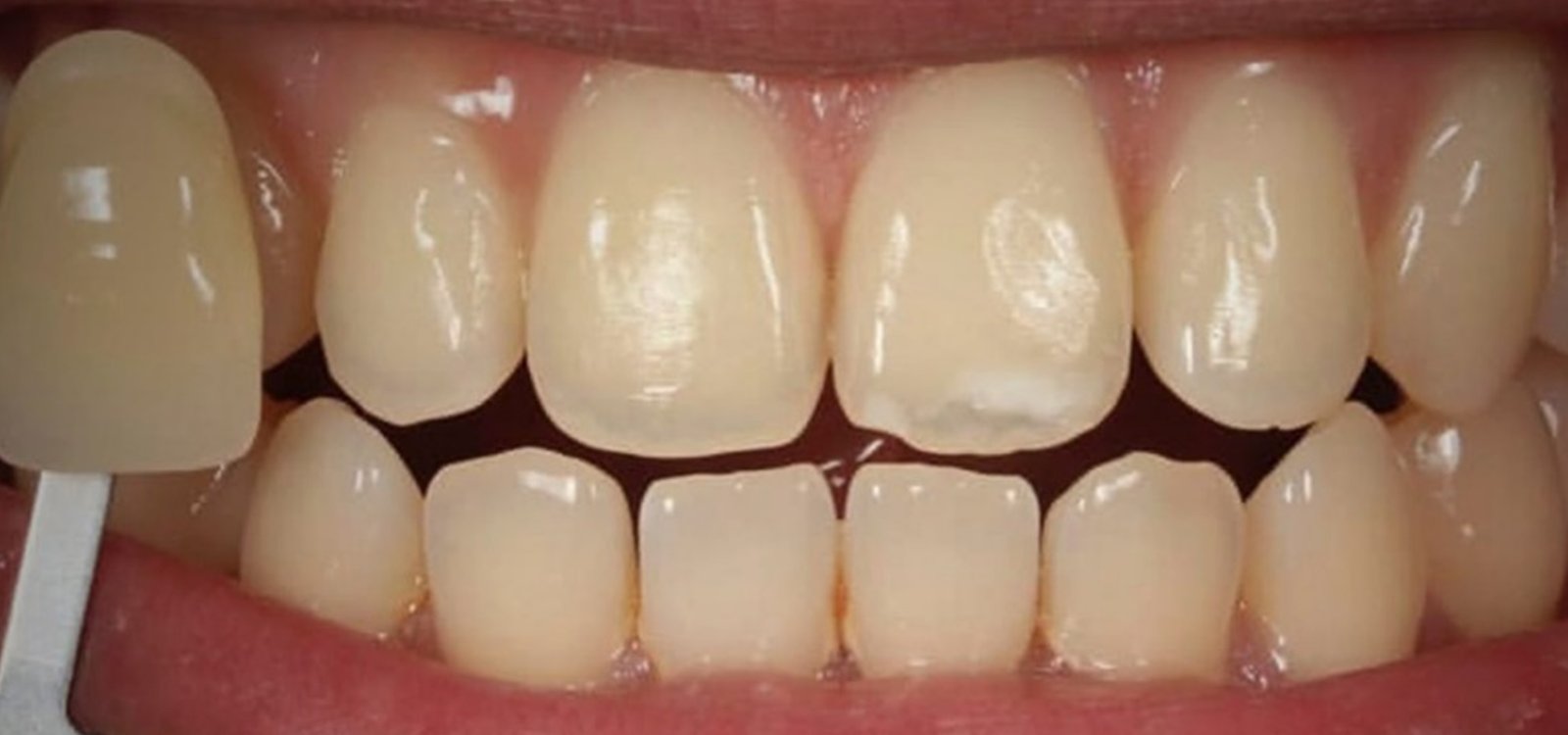 Online Open Access Dental Magazine, Journal, Publication, Dentistry Journal